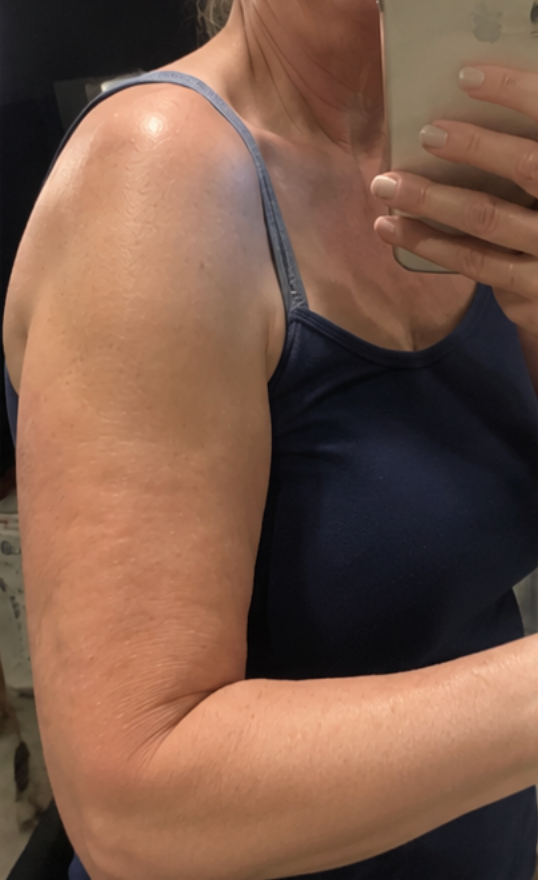 Clara review photo